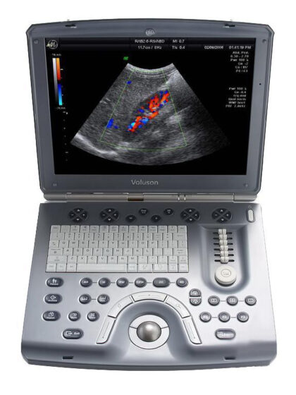 Sistema de Ultrassom Portátil GE Voluson E